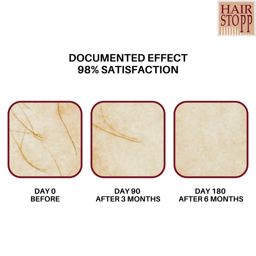 painless hair removal for bikini line